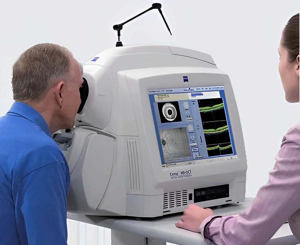 oct tomografo tomografia ocular